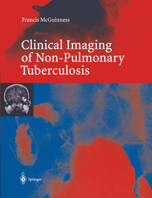 Book cover of Clinical Imaging in Non-Pulmonary Tuberculosis (2000)