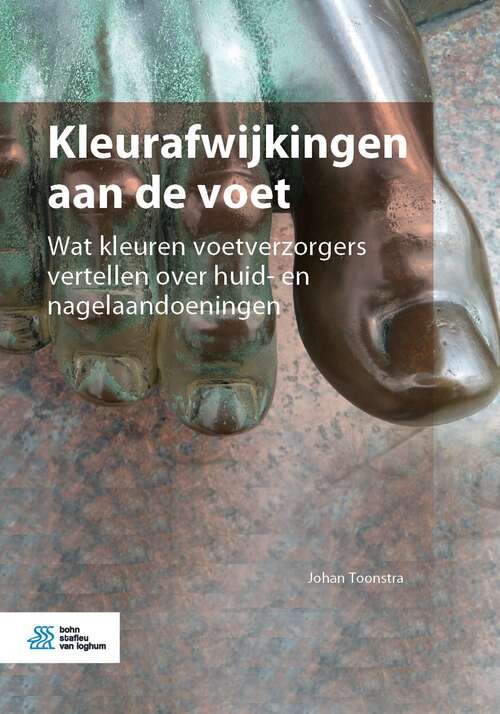 Book cover of Kleurafwijkingen aan de voet: Wat kleuren voetverzorgers vertellen over huid- en nagelaandoeningen (1st ed. 2022)