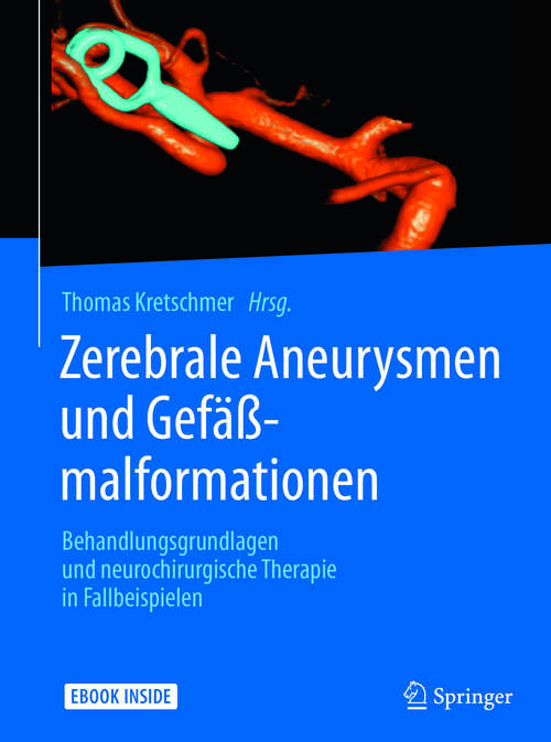Book cover of Zerebrale Aneurysmen und Gefäßmalformationen: Behandlungsgrundlagen und neurochirurgische Therapie in Fallbeispielen (1. Aufl. 2017)