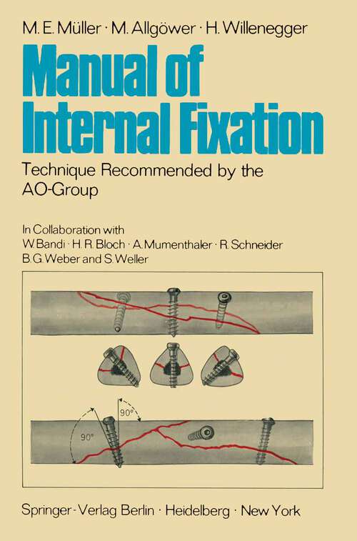 Book cover of Manual of Internal Fixation: Technique Recommended by the AO-Group Swiss Association for the Study of Internal Fixation: ASIF (1970)
