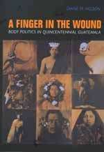 Book cover of A Finger in the Wound: Body Politics in Quincentennial Guatemala (PDF)