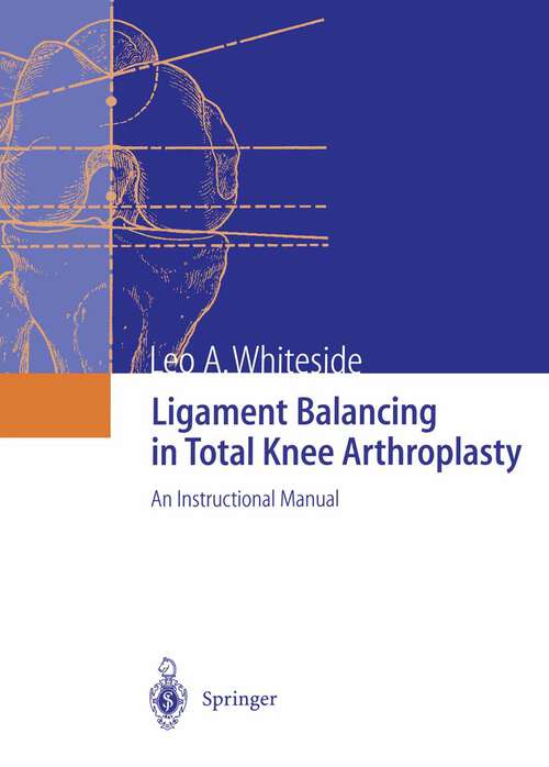 Book cover of Ligament Balancing in Total Knee Arthroplasty: An Instructional Manual (2004)