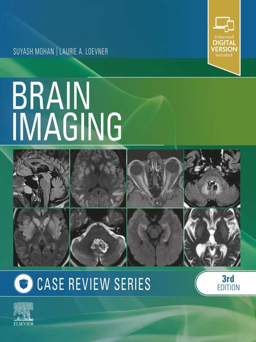 Book cover of Brain Imaging: Case Review Series E-Book (2) (Case Review)