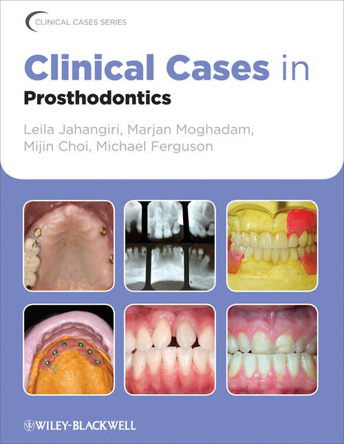 Book cover of Clinical Cases in Prosthodontics (Clinical Cases (Dentistry) #8)