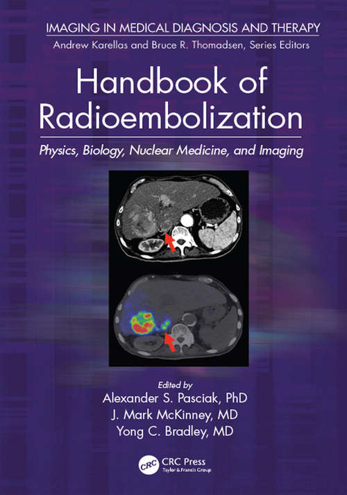 Book cover of Handbook of Radioembolization: Physics, Biology, Nuclear Medicine, and Imaging (Imaging in Medical Diagnosis and Therapy)