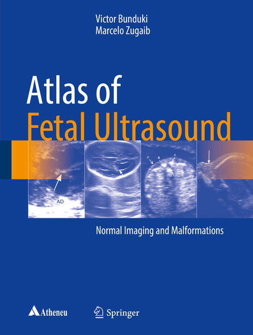 Book cover of Atlas of Fetal Ultrasound: Normal Imaging and Malformations