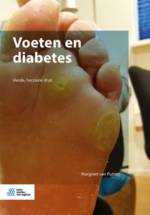 Book cover of Voeten en diabetes