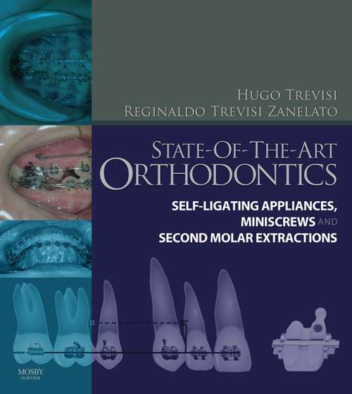 Book cover of State-of-the-Art Orthodontics E-Book: Self-Ligating Appliances, Miniscrews and Second Molars Extraction