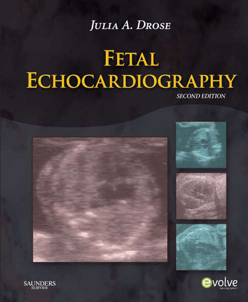 Book cover of Fetal Echocardiography - E-Book