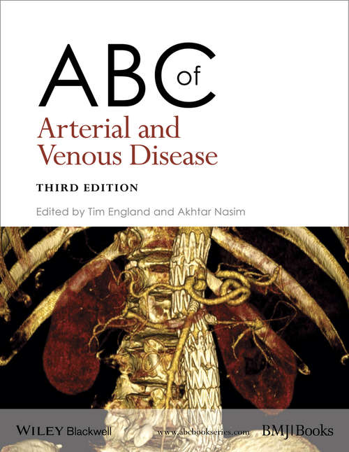 Book cover of ABC of Arterial and Venous Disease: Abc Of Arterial And Venous Disease (3rd Edition) (3) (ABC Series)