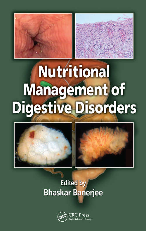 Book cover of Nutritional Management of Digestive Disorders