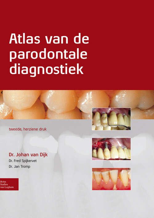 Book cover of Atlas van de parodontale diagnostiek (2nd ed. 2011)