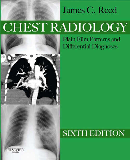 Book cover of Chest Radiology Plain Film Patterns and Differential Diagnoses E-Book: Patterns And Differential Diagnoses (6)