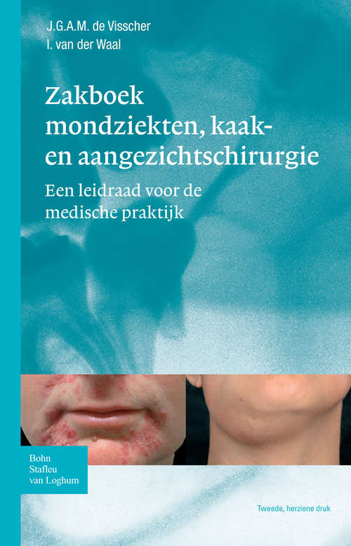 Book cover of Zakboek mondziekten, kaak- en aangezichtschirurgie: Een leidraad voor de medische praktijk (2nd ed. 2010)