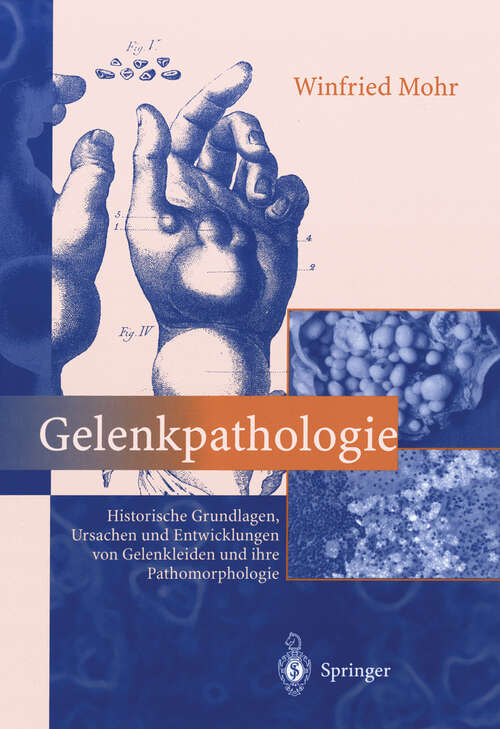 Book cover of Gelenkpathologie: Historische Grundlagen, Ursachen und Entwicklungen von Gelenkleiden und ihre Pathomorphologie (2000)