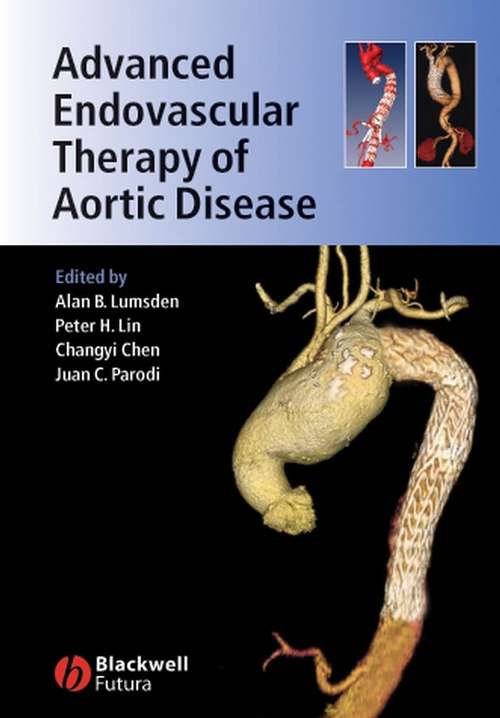 Book cover of Advanced Endovascular Therapy of Aortic Disease