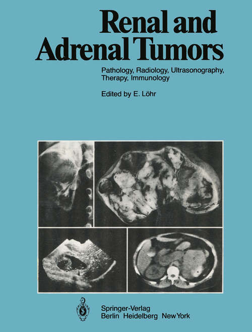 Book cover of Renal and Adrenal Tumors: Pathology, Radiology, Ultrasonography, Therapy, Immunology (1979)