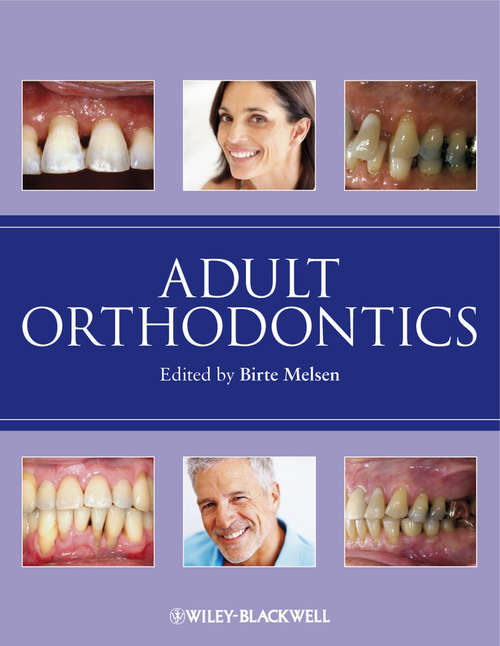 Book cover of Adult Orthodontics