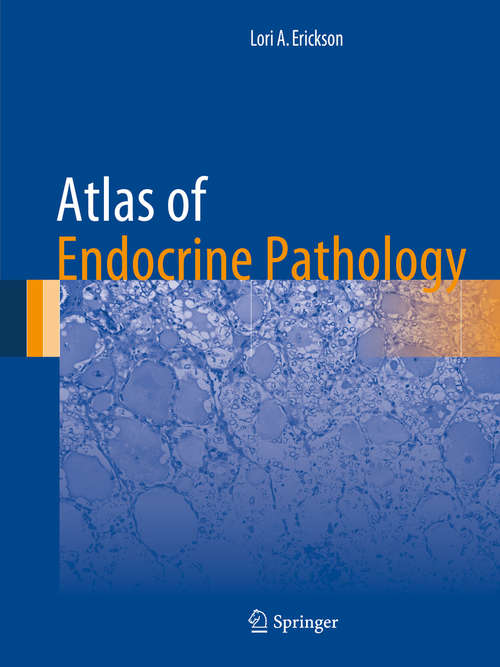 Book cover of Atlas of Endocrine Pathology (2014) (Atlas of Anatomic Pathology)