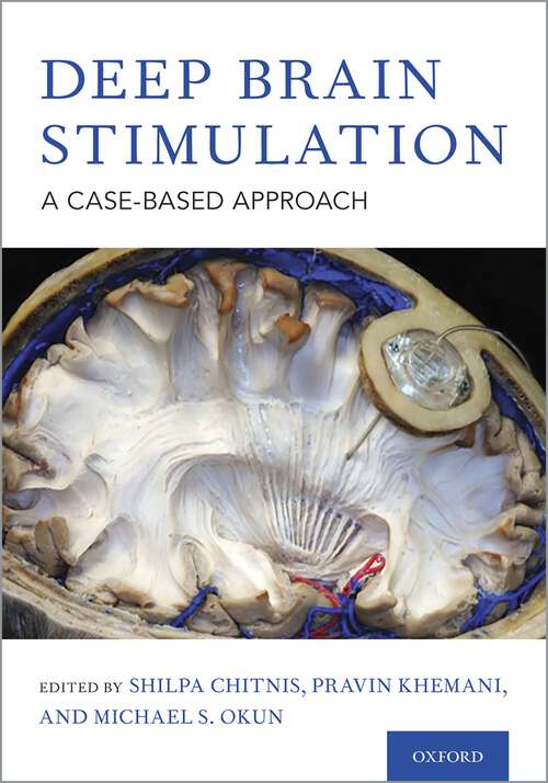 Book cover of Deep Brain Stimulation: A Case-based Approach