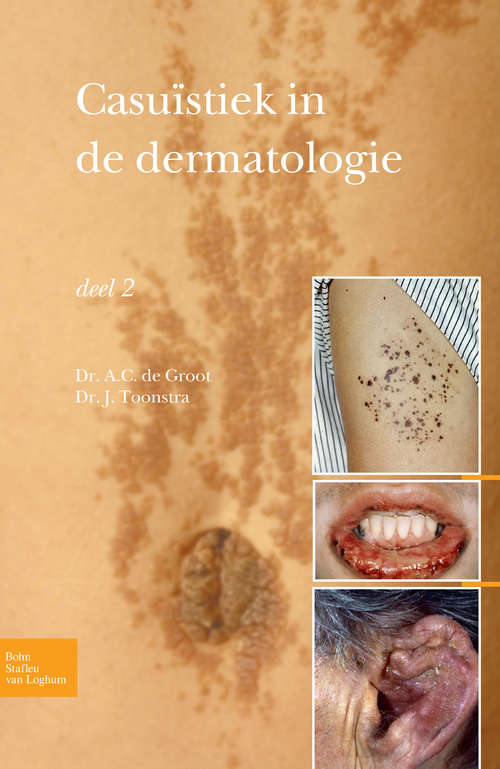 Book cover of Casuïstiek in de dermatologie - deel 2 (2010)