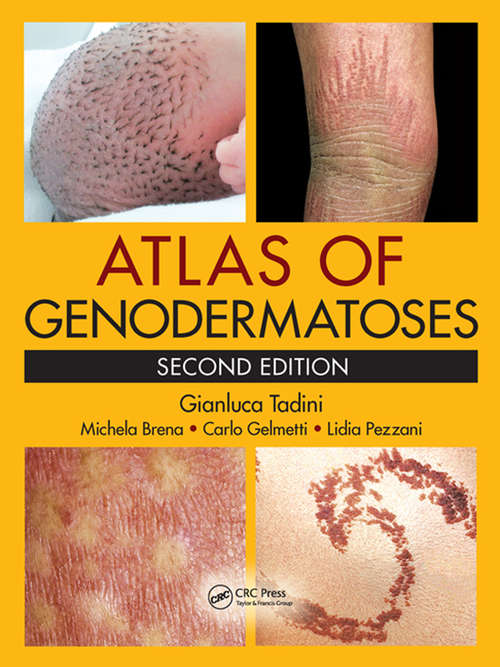 Book cover of Atlas of Genodermatoses (2)