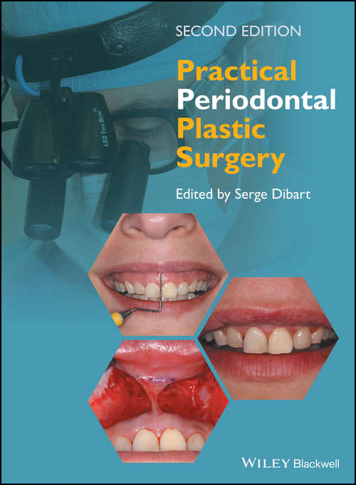 Book cover of Practical Periodontal Plastic Surgery (2)