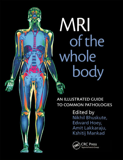 Book cover of MRI of the Whole Body: An Illustrated Guide for Common Pathologies
