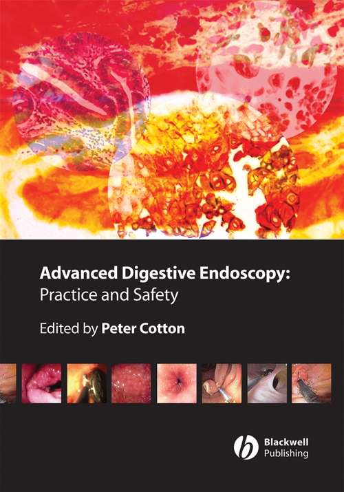Book cover of Advanced Digestive Endoscopy: Practice and Safety
