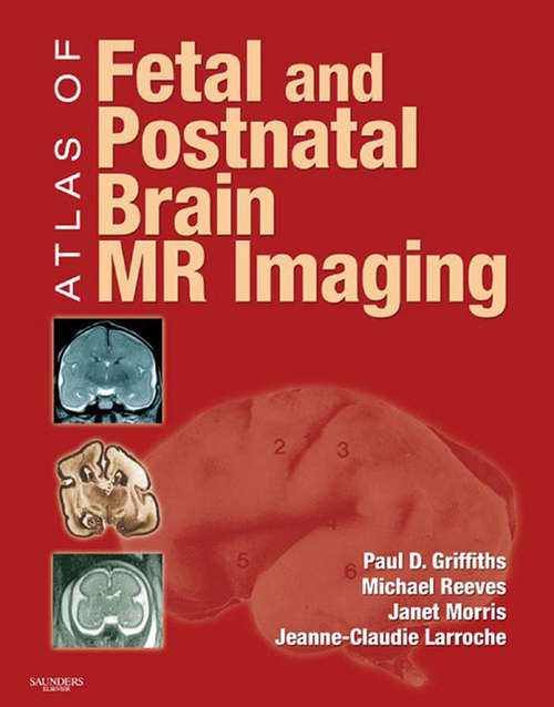 Book cover of Atlas of Fetal and Postnatal Brain MR