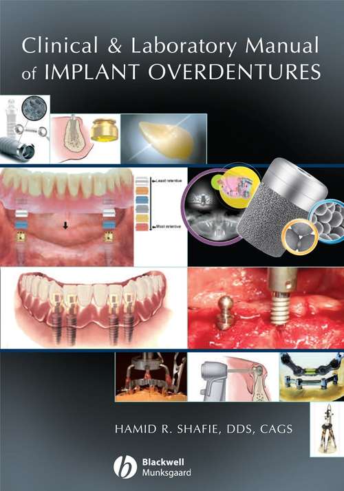 Book cover of Clinical and Laboratory Manual of Implant Overdentures