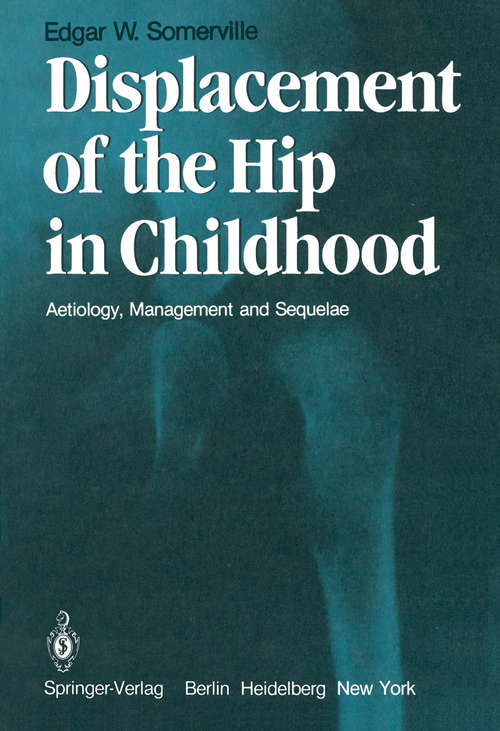 Book cover of Displacement of the Hip in Childhood: Aetiology, Management and Sequelae (1982)
