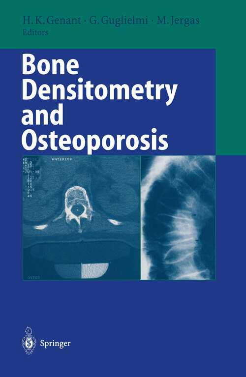 Book cover of Bone Densitometry and Osteoporosis (1998)