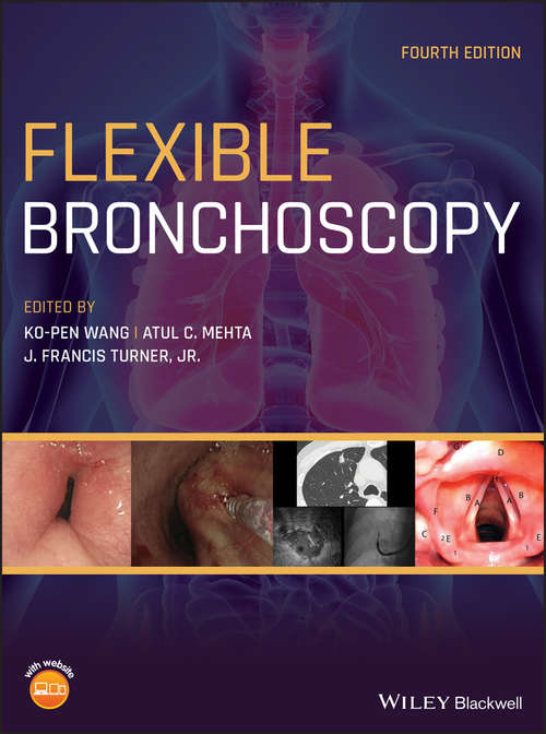 Book cover of Flexible Bronchoscopy (4)