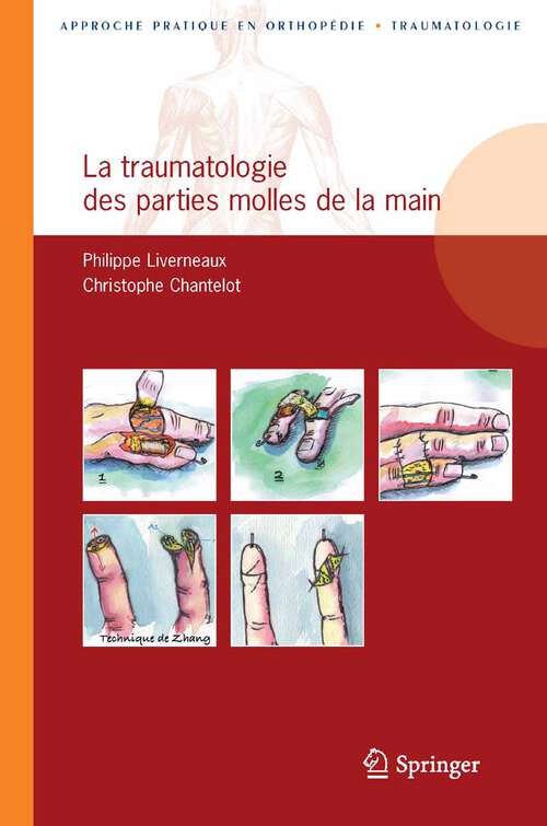 Book cover of La traumatologie des parties molles de la main (2011) (Approche pratique en orthopédie-traumatologie)