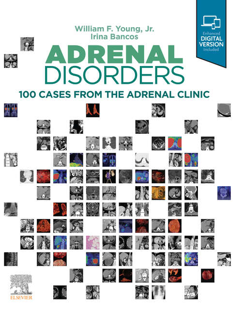 Book cover of Adrenal Disorders,E-Book: Cases from the Adrenal Clinic