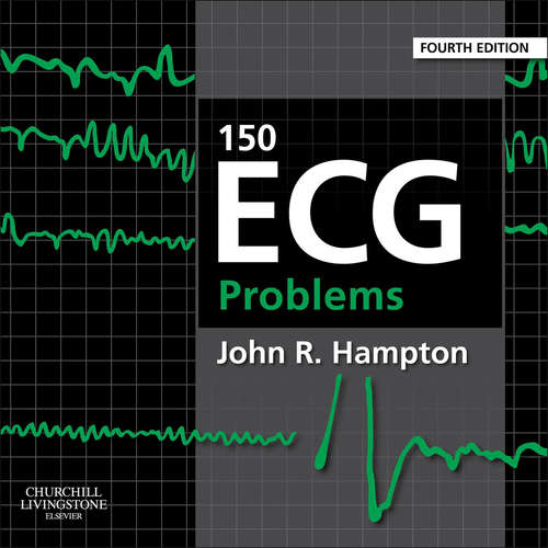 Book cover of 150 ECG Problems E-Book (4)