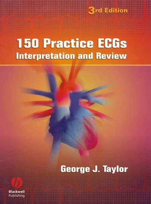 Book cover of 150 Practice ECGs: Interpretation and Review (3)
