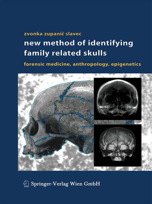 Book cover of New Method of Identifying Family Related Skulls: Forensic Medicine, Anthropology, Epigenetics (2004)