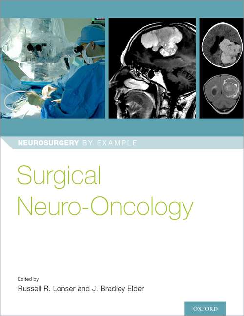 Book cover of Surgical Neuro-Oncology (Neurosurgery by Example)