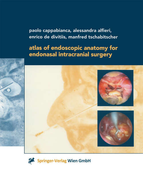 Book cover of Atlas of Endoscopic Anatomy for Endonasal Intracranial Surgery (2001)