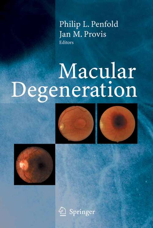 Book cover of Macular Degeneration (2005)