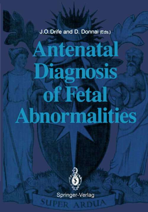 Book cover of Antenatal Diagnosis of Fetal Abnormalities (1991)