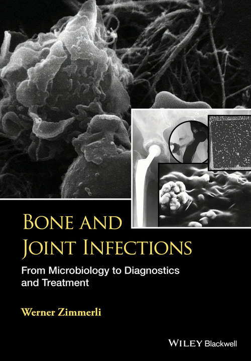 Book cover of Bone and Joint Infections: From Microbiology to Diagnostics and Treatment