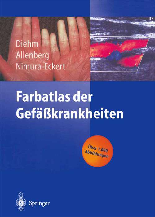 Book cover of Farbatlas der Gefäßkrankheiten (1999)