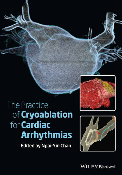 Book cover of The Practice of Catheter Cryoablation for Cardiac Arrhythmias