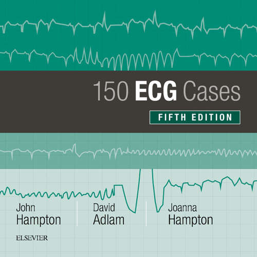 Book cover of 150 ECG Cases (5)