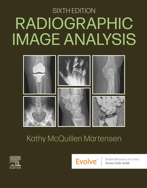 Book cover of Radiographic Image Analysis - E-Book: Radiographic Image Analysis - E-Book