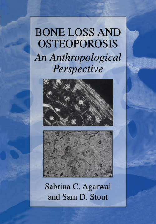 Book cover of Bone Loss and Osteoporosis: An Anthropological Perspective (2003)