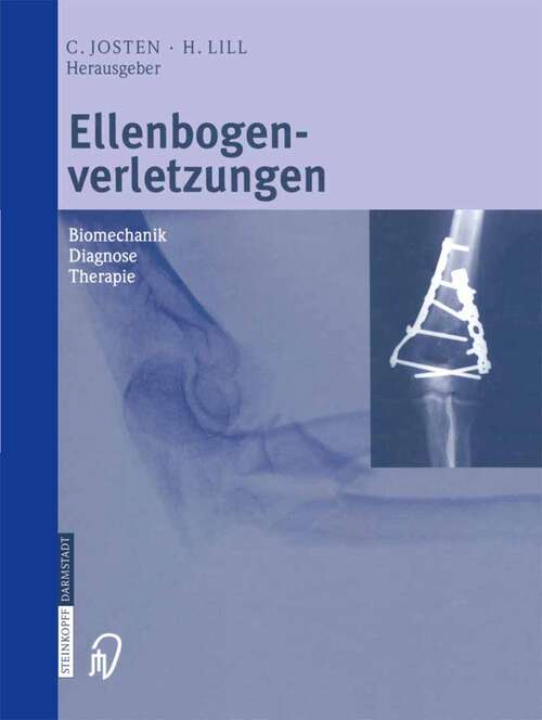 Book cover of Ellenbogenverletzungen: Biomechanik ■ Diagnose ■ Therapie (2002)